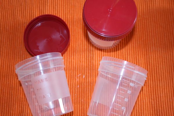 10 Stück 120 ml Schraubdosen roter Deckel
