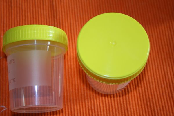 100 Stück 120 ml Schraubdosen gelber Deckel